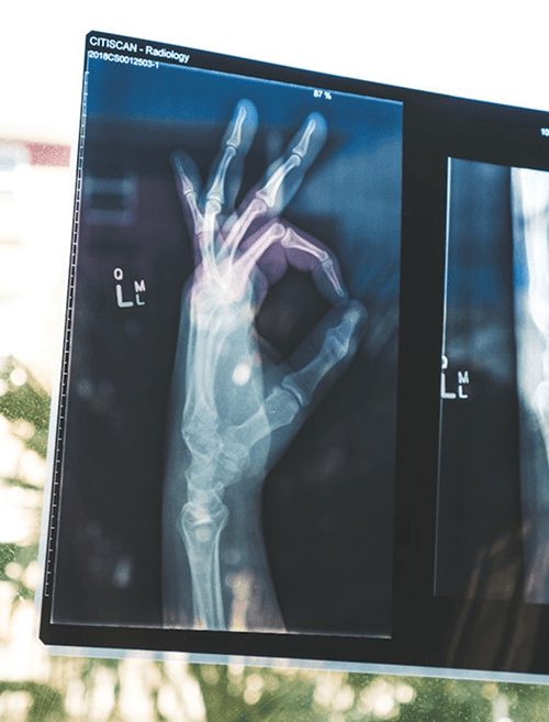 GCG works X-ray image on a medical screen, illustrating diagnostic imaging and healthcare technology under Gaurssa’s health division.